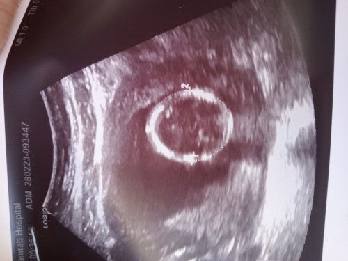 ส่วนไหนของน้อง