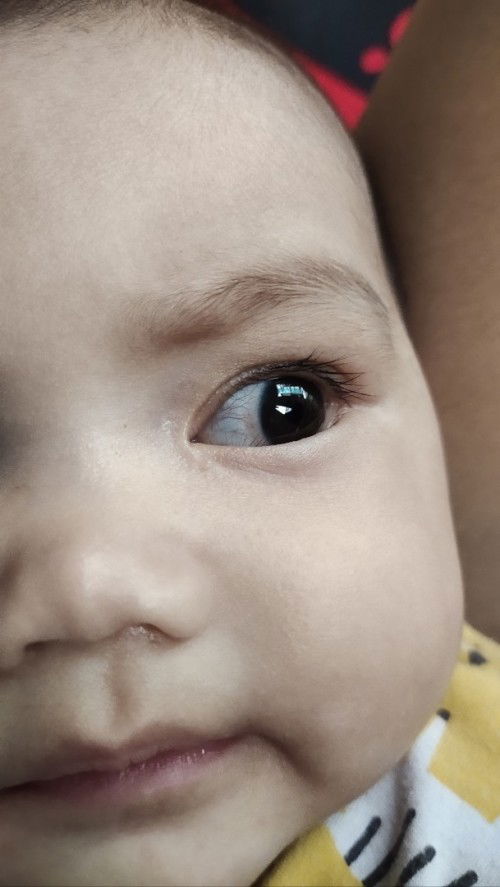Mata bayi 5 bulan merah