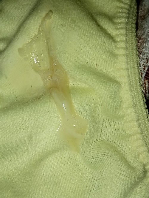 Mucus plug napo ba ito