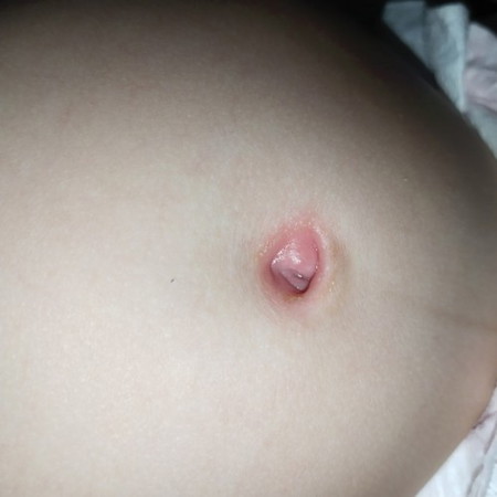 Mga momsh ano po kaya ang cause niyan and ano po dapat ang gawin? 3mos old po c baby.