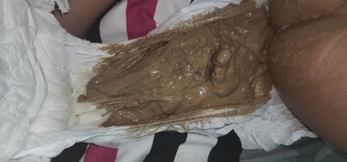 Poops ni baby
