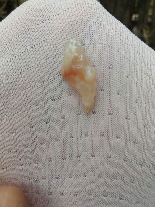 Keluar lendir coklat