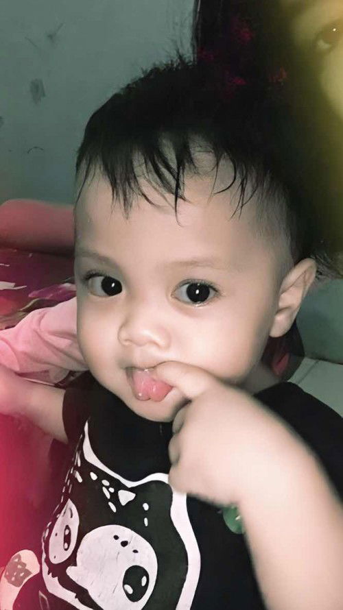 Bayi 11 bulan 8 hari ujung lidah terlihat membelah dua?