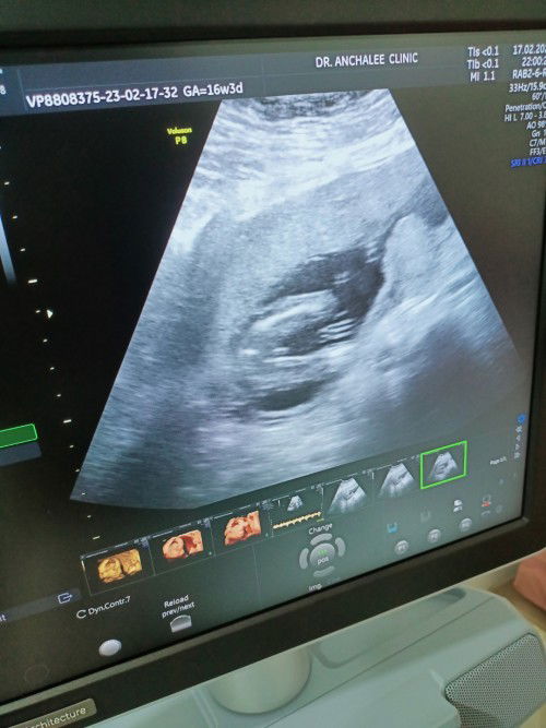 เพศชายหรือ