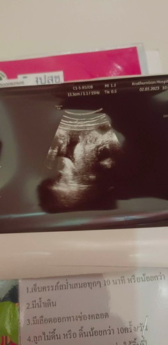 แม่ๆคนไหนดูเป็นบ้างคะว่าคือส่วนไหนของลูก