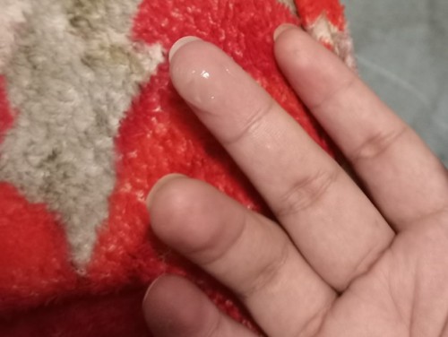 Parang sipon na discharge