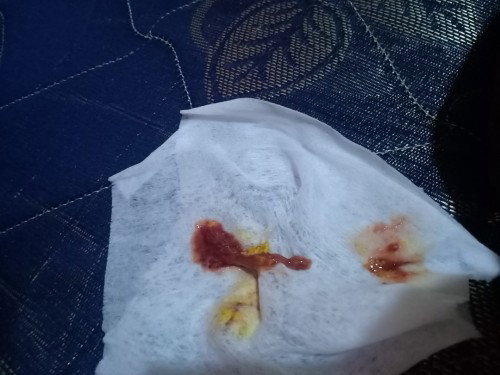 Pup berwarna coklat tua berlendir