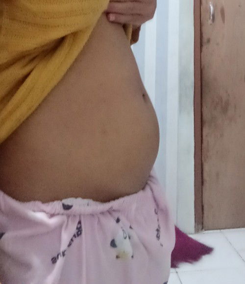 Curhat dikit ya bun saya ini 2minggu yg lalu lagi mens tpi perut seperti yg d foto ini