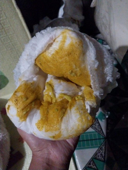 Foto BAB bayi 5bulan