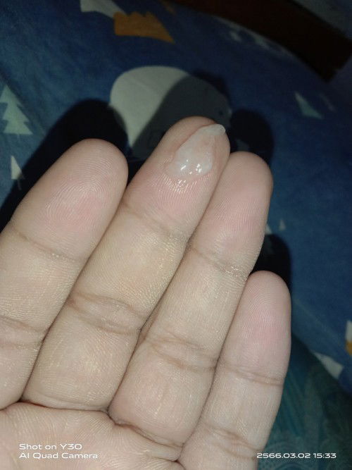 ขอสอบถามแม่ๆหน่อยนะค่ะมีมูกใสๆออกแบบนี้ควรไปหาหมอมั้ยค่ะ