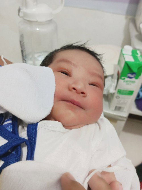 9 CM NO LABOR