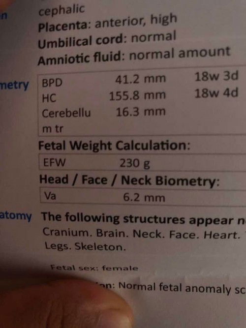 17+5ไปซาวหมอบอกน้ำหนักลูก230g 
 แม่ๆคิดว่า น้อยไป รึเยอะไปคะ
