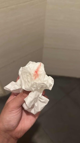 egg white discharge with a streak of blood