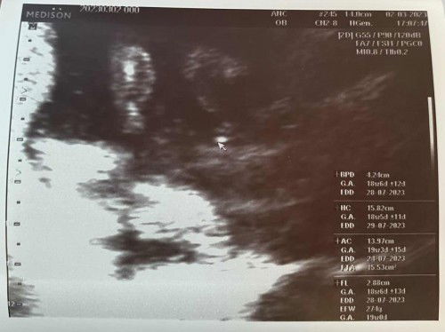 ท้องได้กี่สัปดาห์