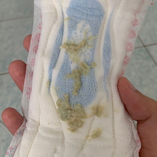 keputihan macam ni ade risiko ke ?