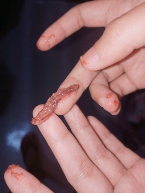 Hello po mga mommy , mag bigla po lumabas sa pwerta ko na ganito. wala po syang amoy ,