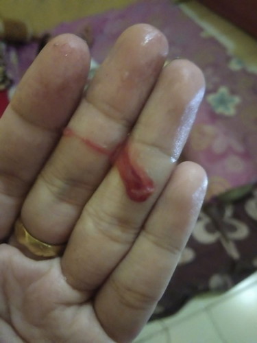 Lendir darah