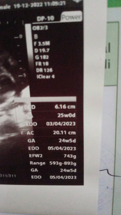 Hpl yang mana lewat hasil usg