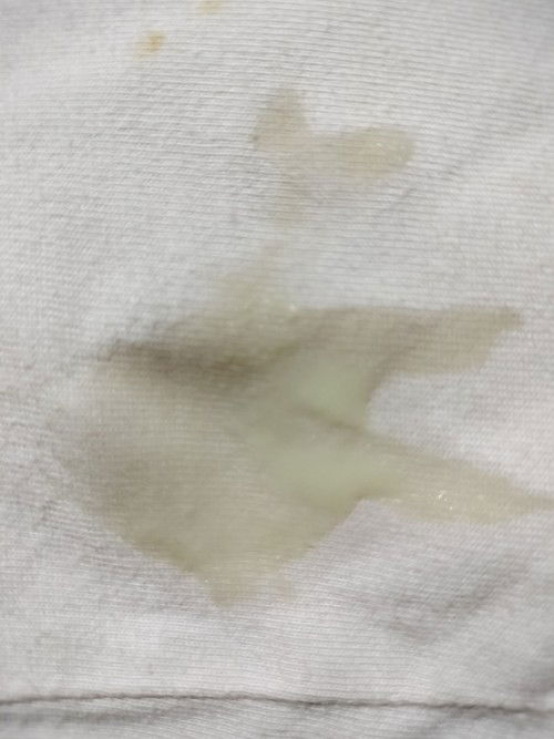 Keputihan saat hamil