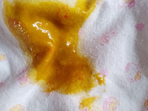 ขอสอบถามน้อยค่ะ ตอนนี้น้องได้2เดือนครึ่งแล้ว อึออกมาเป็นแบบนี้ปกติค่ะไหมค่ะ อึวันหนึ่ง3-4ครั้ง กินนม