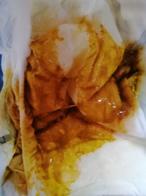 S26 Gold Normal po ba ganito poop ni baby