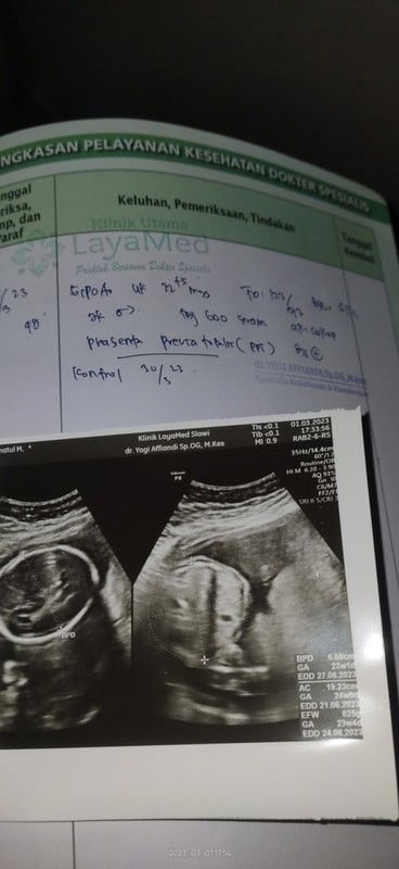 Plasenta previa totalis atau ppt