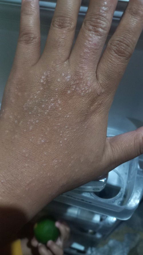 Udh bingung gimana lagi