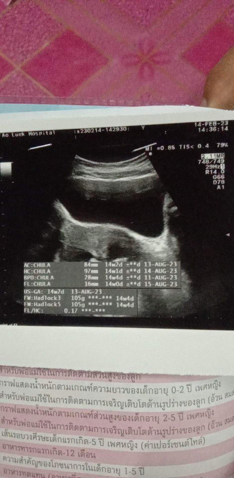 น้ำหนักลูกในครรภ์