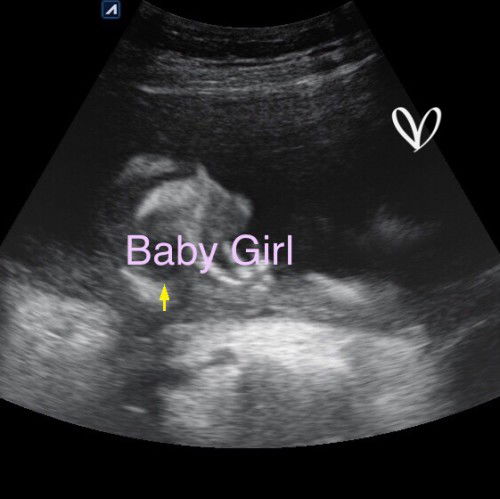 Alhamdulillah Baby Girl