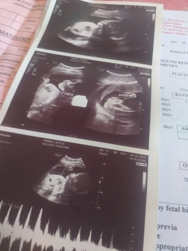 Pede po ba pabasa at tingnan kung ok si baby sa ultrasound niya, pls po thankyou😇