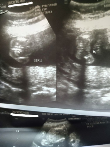 Gender reveal