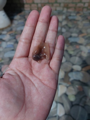 ท้องได้ 36 สัปดาห์ แบบนี้เรียกว่ามูกเลือดไหมคะ