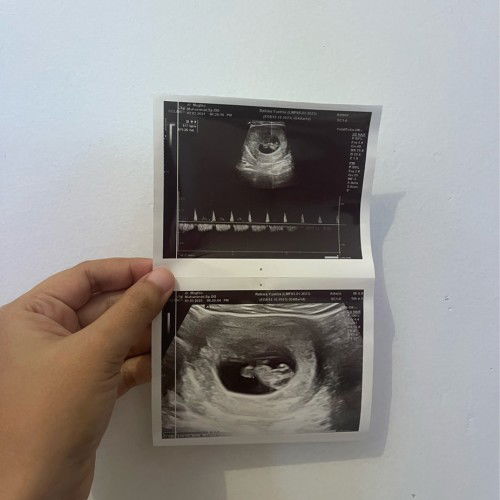 Info Dokter Obgyn Bogor