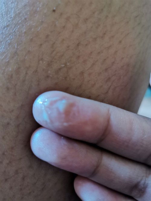 Pa Advice po sa makakakpansin ty