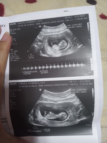 first time mom po
please respect po ๐