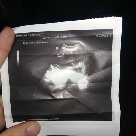 100% sure na baby boy na po ba eto? Di pa rin ako na pagbigyan ng girl 😔