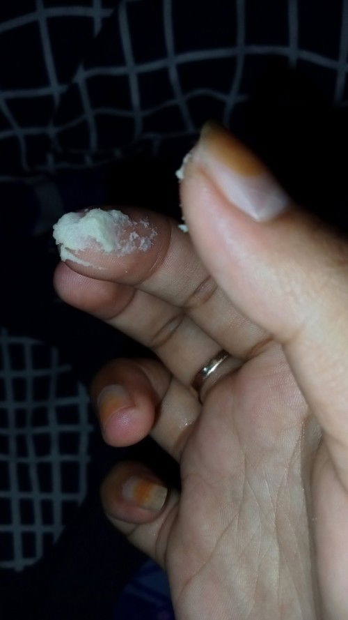 Keputihan seperti ampas tahu