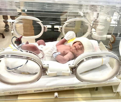 39+1 weeks แตกแล้วค่ะ (ผ่าคลอด) รพ.กรุงเทพ ศูนย์วิจัย