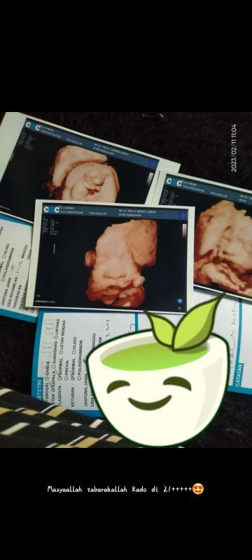 Hpl Maret udah pada launching belum bunda 😍🌸