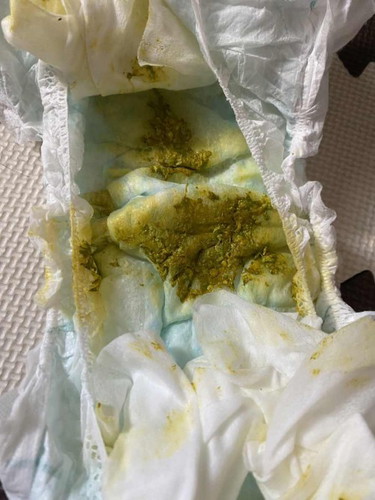 Greenish poop ni baby (Pure breastfeed)