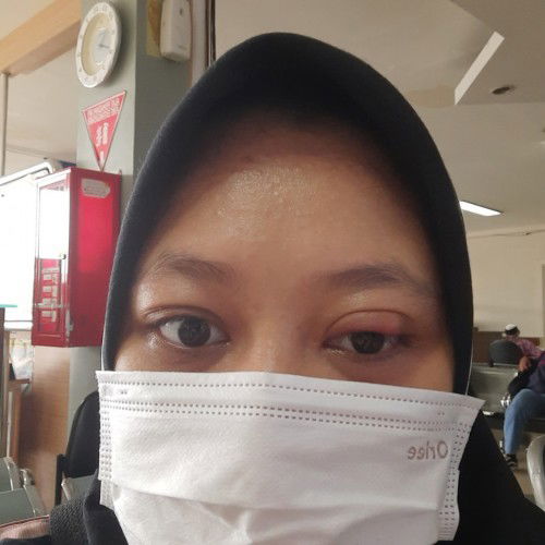 Macem macem bawaan hamil