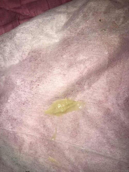 Keputihan selepas bersalin 3 bulan