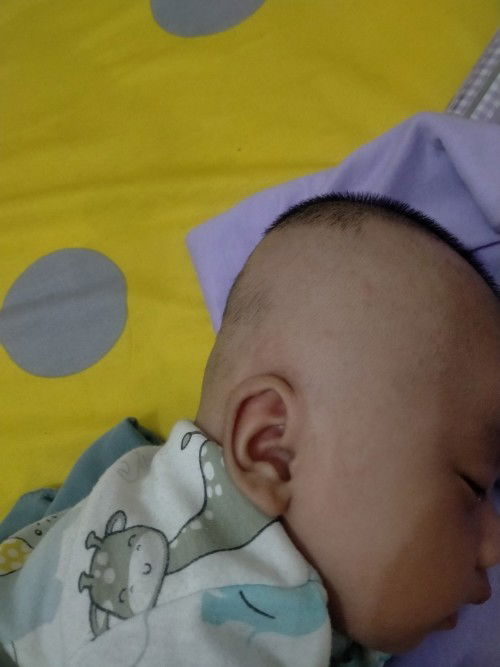 Kepala baby 2bulan