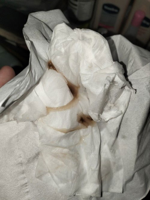 Keluar lendir coklat