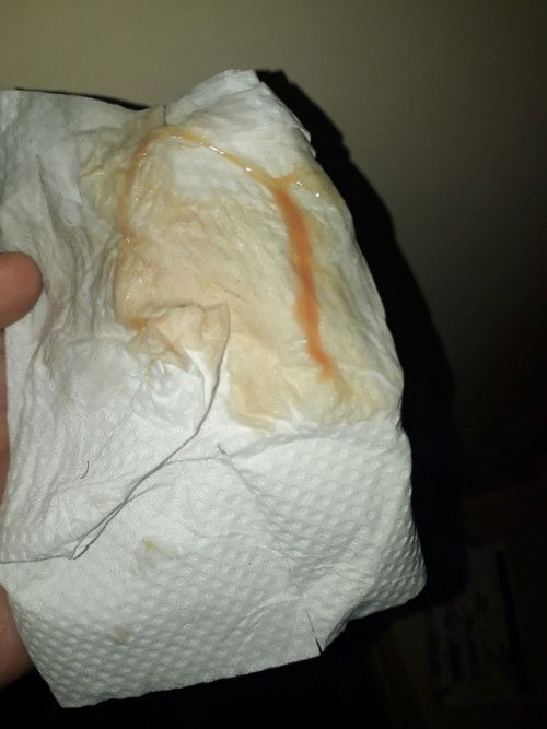 Any one po who experience this..can u share po kung what is this