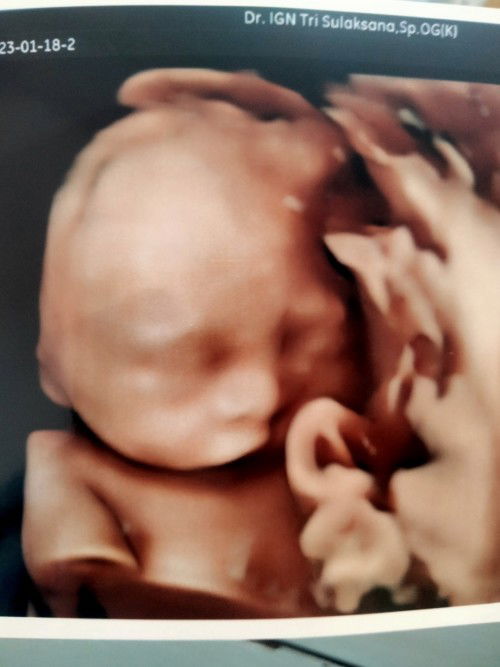 Semoga diagnosanya salah 😭