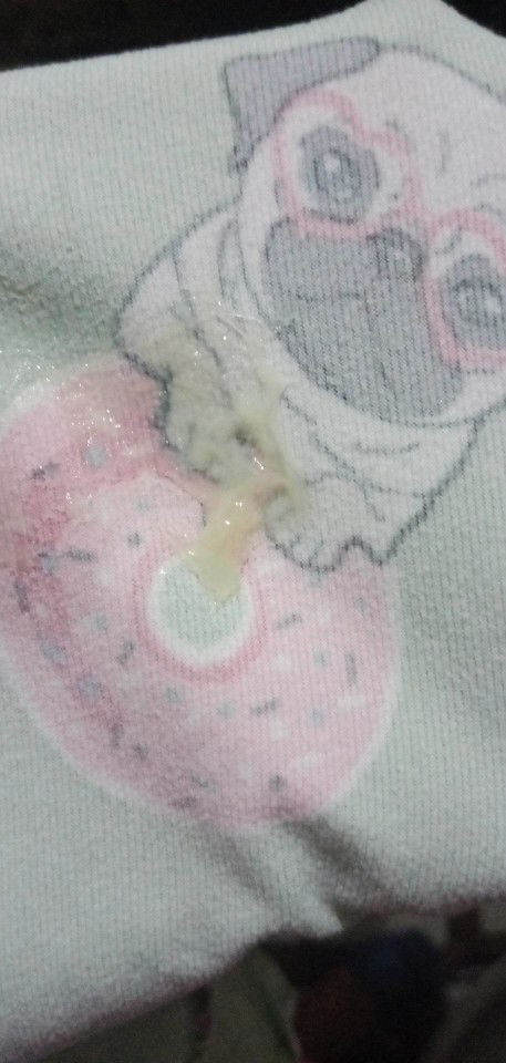 White thick discharge