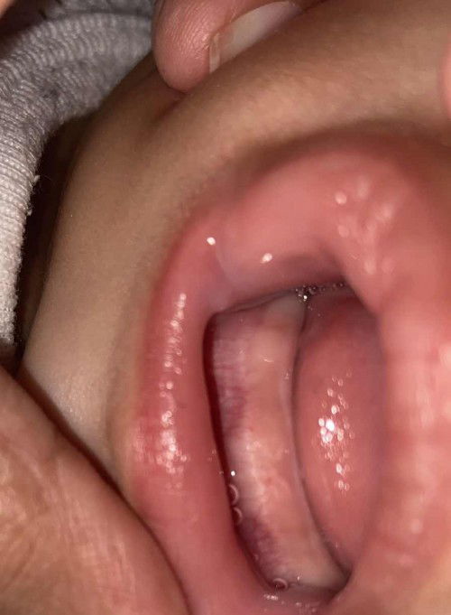 assalamualaikum ni nk tumbuh gigi ke ?