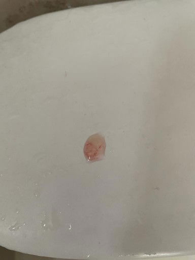 Keluar lendir kemerahan