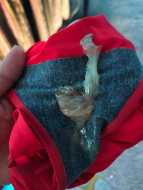 Sorry mga mi.. Aask lng ako..